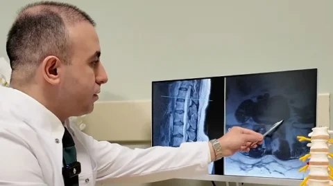 Bel Fıtığında Ameliyat Son Çare Olmalı: Uzman Uyarıyor